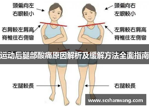 运动后腿部酸痛原因解析及缓解方法全面指南
